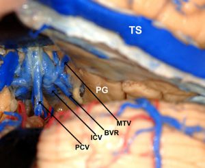 Figure 5b