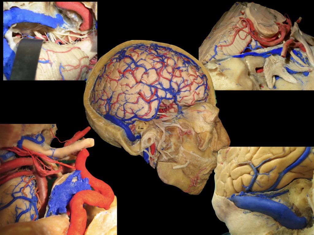 Brain Collage