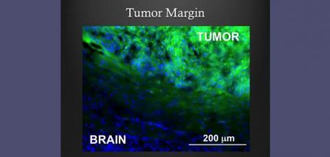 tumor_margin