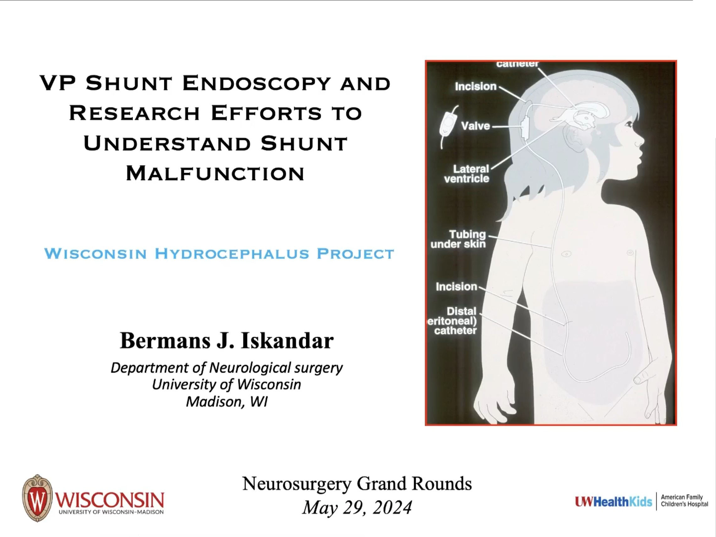 HYBRID GRAND ROUNDS – May 29, 2024 Dr. Bermans Iskandar – Department of ...